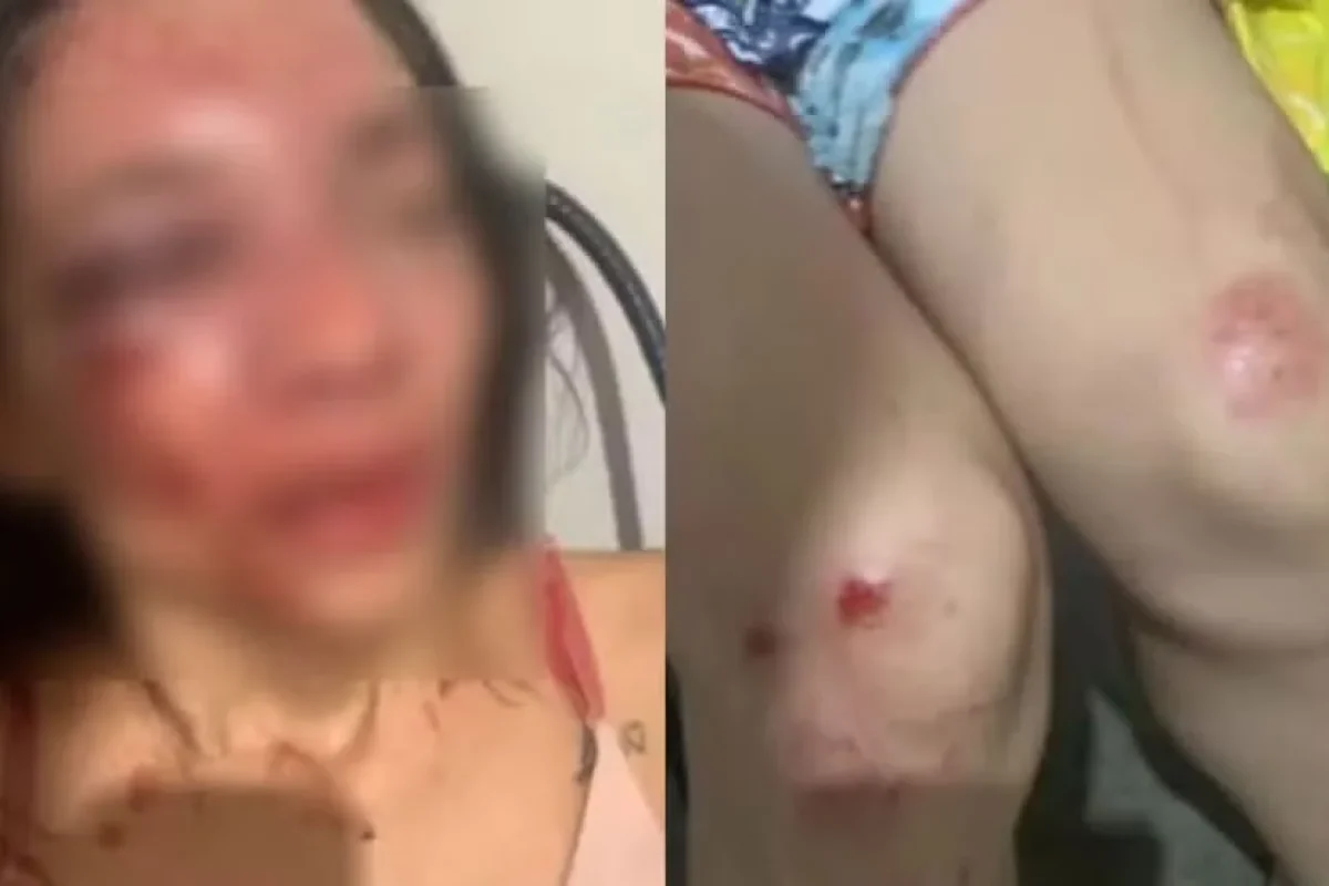 Foto: Reprodução